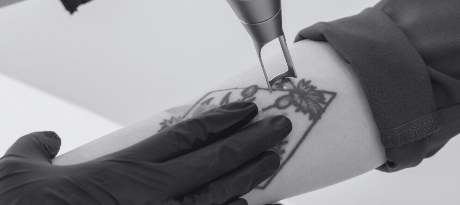 Cosmetologist removing tattoo with laser device female hand. Concept of erasing tattoos as expensive procedure in cosmetology clinic